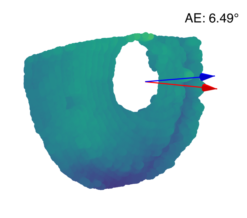Reconstructed iris with camera and light ray refraction (CRR + LRR), subject 1.