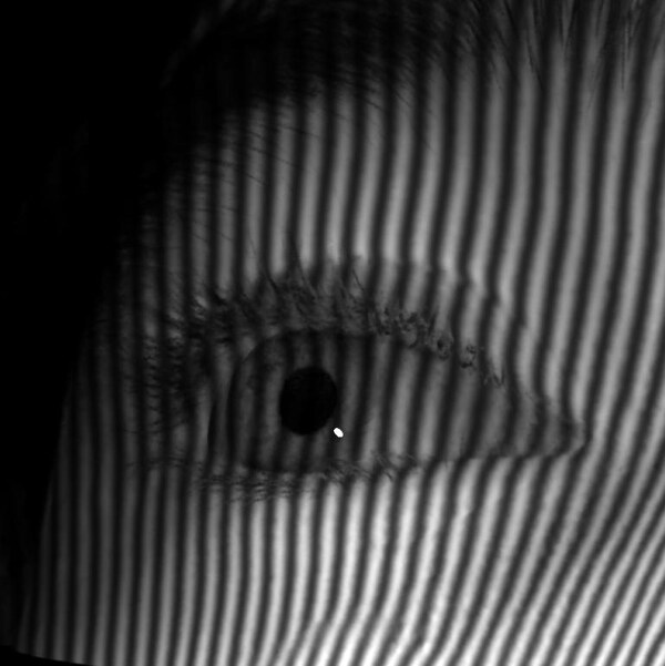Eye rendered with simulated structured light.