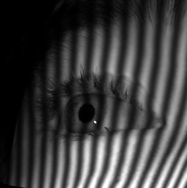 Eye rendered with simulated structured light.